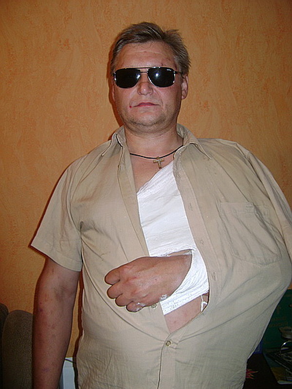 Андрей Саламатов после инцидента на стадионе Динамо