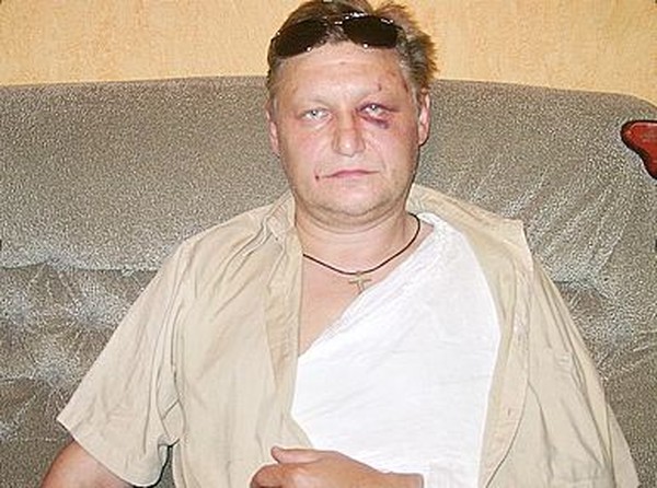 Андрей Саламатов после инцидента на стадионе Динамо